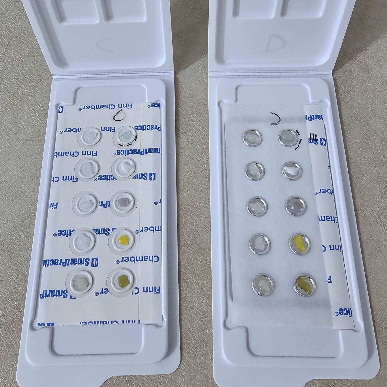 Patch Testing Toothpaste Patch test – Mario Zanforlin – Allergologo